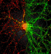 インスリンで記憶障害予防？
