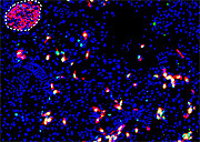 インスリンを作る細胞を作製