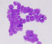 癌患者のDNAをすべて分析